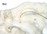 Porzione basale di un filamento epifita su Lithophyllum byssoides